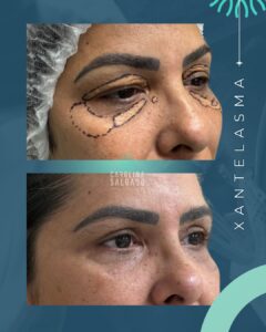 ANTES & (1080 x 1350 px).jpg (1)